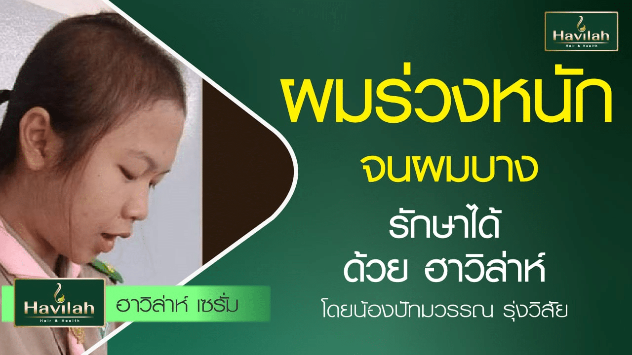 imgi_51_ปกลูกค้าแชมพูรีวิว_03_Youtube_B_A_1280x720_copy_3_0